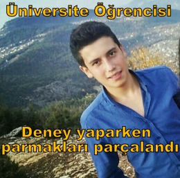 Çamlıyayla’da Deney Yapan Üniversite öğrencisinin parmakları parçalandı 
