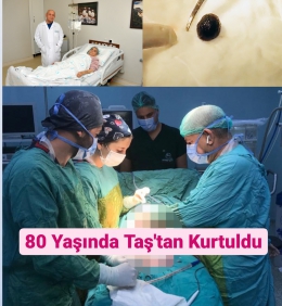 33 Yıllık Cerrah Mehmet Ali Sun'u Şaşırtan Safra Kesesi Taşı