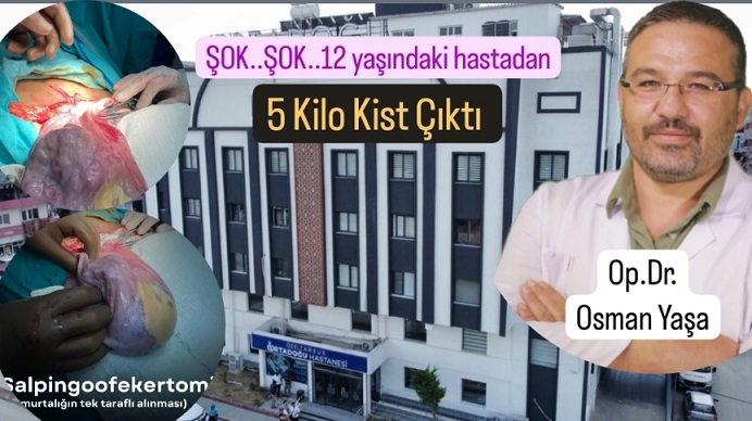 Tarsus Ortadoğu Hastanesinde 12 Yaşında Hastadan 5 kg Kist Alındı